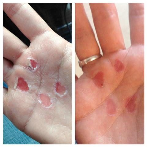 Winnies RipFix Standard Size