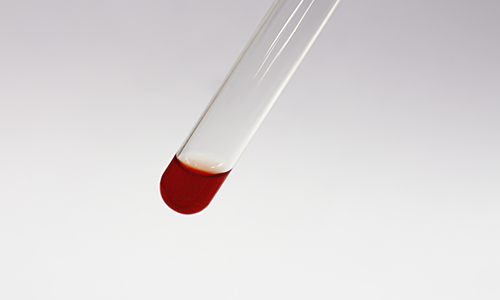 imagen servicio medida hemoglobina glicolisada