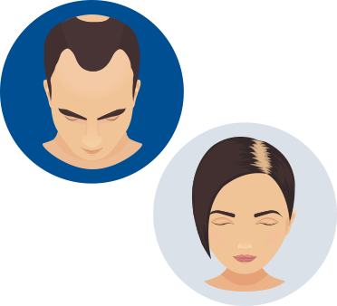 Different Types Of Hair Loss