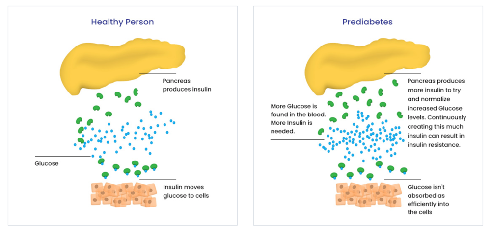 predia-prediabetes.png
