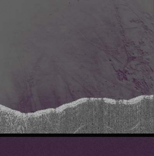 Lumisokea - Apophenia - LP Vinyl