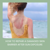 How to Repair a Damaged Skin Barrier After Sun Exposure