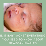  Is it Baby Acne? Everything You Need to Know about Newborn Pimples