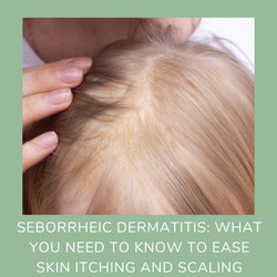 Seborrheic Dermatitis: What You Need to Know to Ease Skin Itching and Scaling