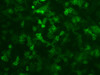 PD-L1 mRNA [100 ug]