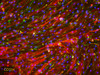 ABiEndothelial