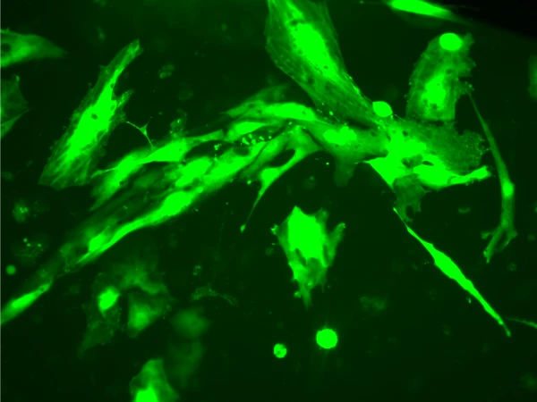 ABiEndothelial