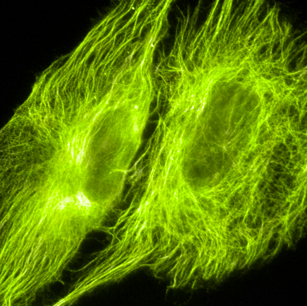 Fluorescence imaging of mNeonGreen fusion vectors in microtubules.