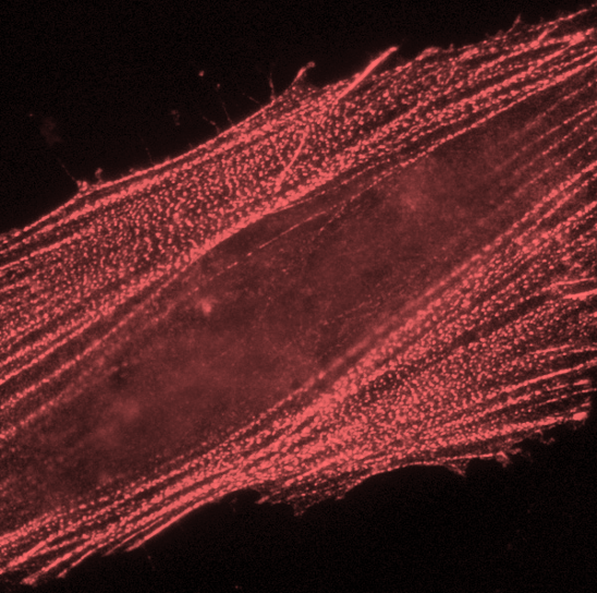 mScarlet3 mRNA EXPRESS™