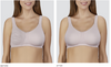 Balance Adapt Air Medium Delta Adjustable Breast Shaper 
Before and After Breast Asymmetrical