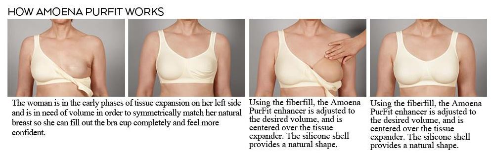 Breast Enhancement  During Breast Reconstruction ExpansionAmoena