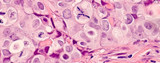 Earlier – and Better – Cancer Detection