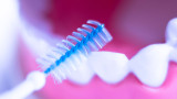 Benefits Of Flossing With Interdental Brushes & Power Water Flossers