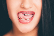 Insight: The 80/20 Rule Relevant to Cleaner Teeth: Get the Gap!