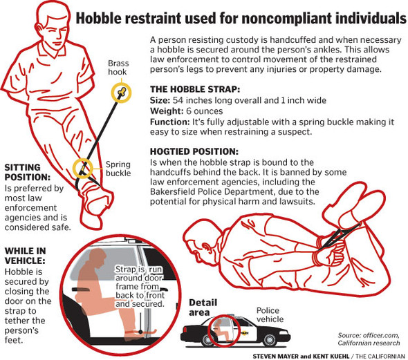 KZ Hobble Restraint