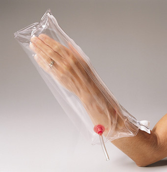 Inflatable Splint Hand and Wrist