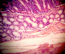 Enhancing Gram Stain Reliability: Techniques to Prevent Gram-Negative Errors
