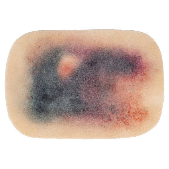 TraumaSim Self-Adhesive Large Haematoma TraumaSim Self-Adhesive Large Haematoma