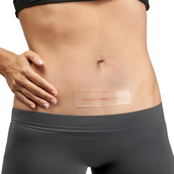 Sheets 3 x 12cm Box of 2 AeroScar Silicone Scar