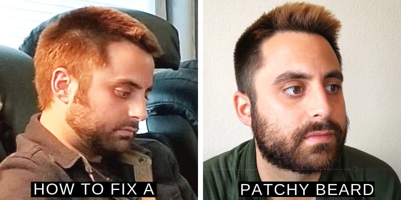 Fix Your Patchy Beard for Good The Top Ways to Cover Bald Spots