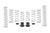 Eibach 14-16 Polaris RZR XP 4 1000 EPS Pro-UTV Stage 2 Performance Springs - E85-209-039-02-22 Photo - Primary
