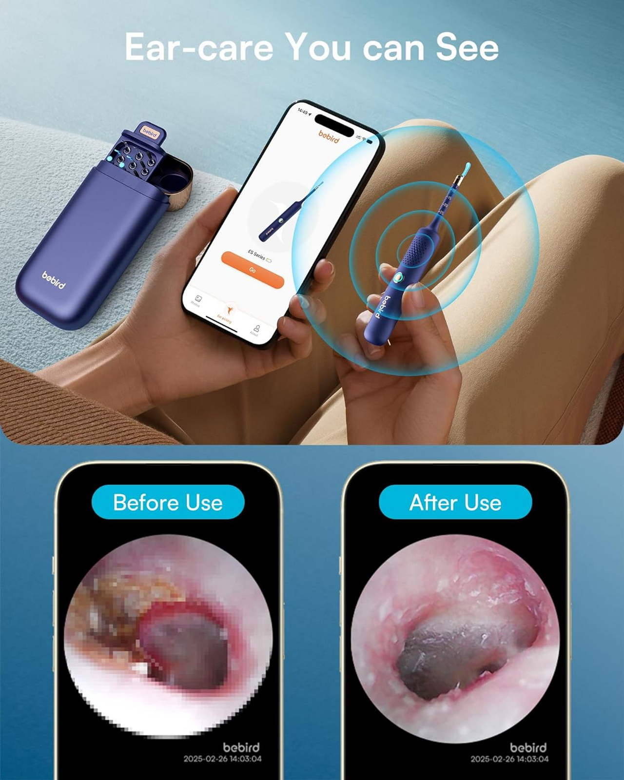 A person using the Bebird smart ear cleaner, with the live camera feed from inside their ear clearly displayed on a smartphone screen.