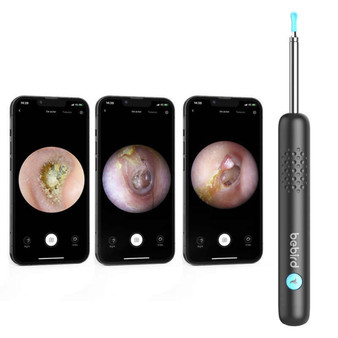 Bebird R1+ Ear Wax Removal Cleaner Wax Removal Kit Ear Camera Otoscope with Light Cleaning Kit with 1080P