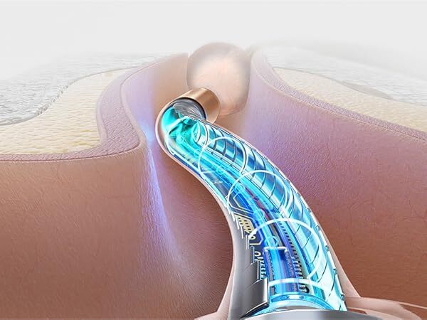 Earwax Removal tool Flexi-otsoscope Comfort