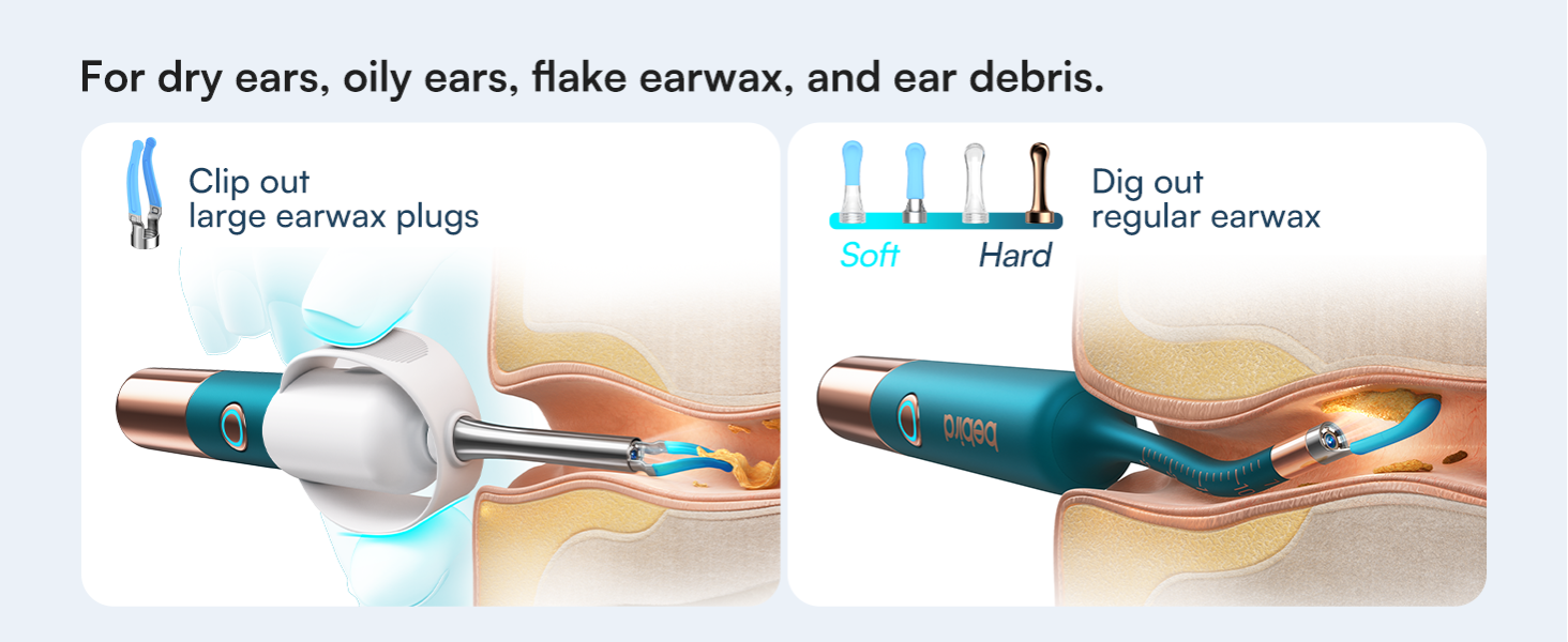 Bebird Earsight Ultra Ear Wax Removal Tool Camera, Ear Cleaner with Flexible Ear Camera Otoscope, Painless Visual Ear Pick Tweezers, Visual Scope Earwax Cleaning Dropper, Ear Cleaning Kit for Family