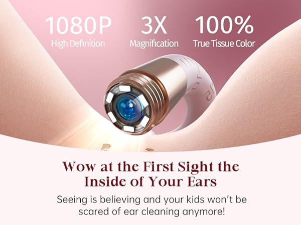 Bebird EarSight Plus Pink Ear Wax Removal Tool Camera, Ear Cleaning Kit with Flexible Visual Ear Camera Otoscope, Portable Wireless Painless Ear Cleaner with Earwax Remover Tweezers for Adults, Kids, Pets