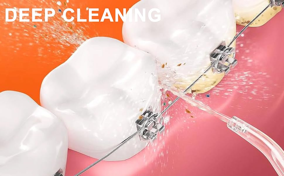 Water Flosser Bitvae C6 Replacement Tips for Deep Cleaning