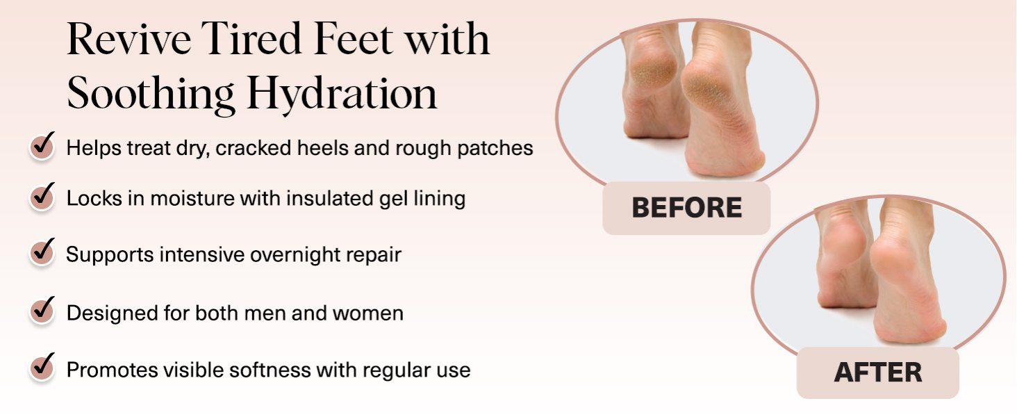 Kitsch Moisturizing Socks for Cracked Heel Treatment – Moisturizing Reusable Gel Socks for Women & Men, Overnight Heel Socks with Insulated Gel Lining for Dry Cracked Feet, Open-Toe Design - 1 Pair