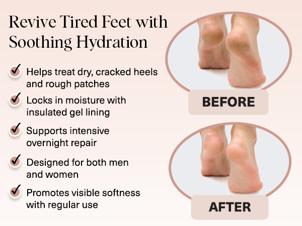 Kitsch Moisturizing Socks for Cracked Heel Treatment – Moisturizing Reusable Gel Socks for Women & Men, Overnight Heel Socks with Insulated Gel Lining for Dry Cracked Feet, Open-Toe Design - 1 Pair