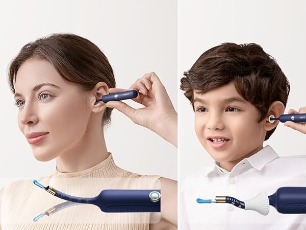 Earwax Removal tool - Customizable Ear Scope