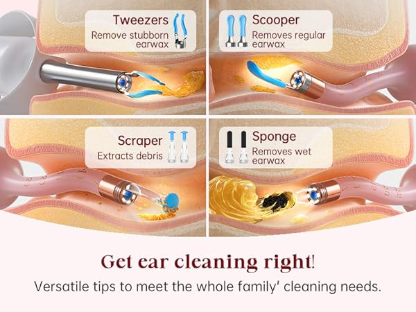 Bebird EarSight Plus Pink Ear Wax Removal Tool Camera, Ear Cleaning Kit with Flexible Visual Ear Camera Otoscope, Portable Wireless Painless Ear Cleaner with Earwax Remover Tweezers for Adults, Kids, Pets