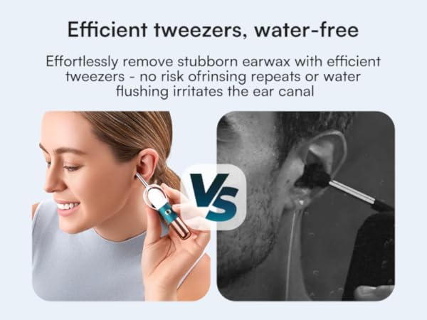 Bebird Earsight Ultra Ear Wax Removal Tool Camera, Ear Cleaner with Flexible Ear Camera Otoscope, Painless Visual Ear Pick Tweezers, Visual Scope Earwax Cleaning Dropper, Ear Cleaning Kit for Family