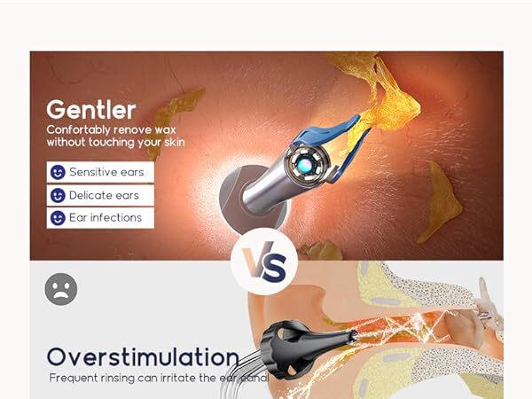 Earwax removal gentle tweeze no skin contact