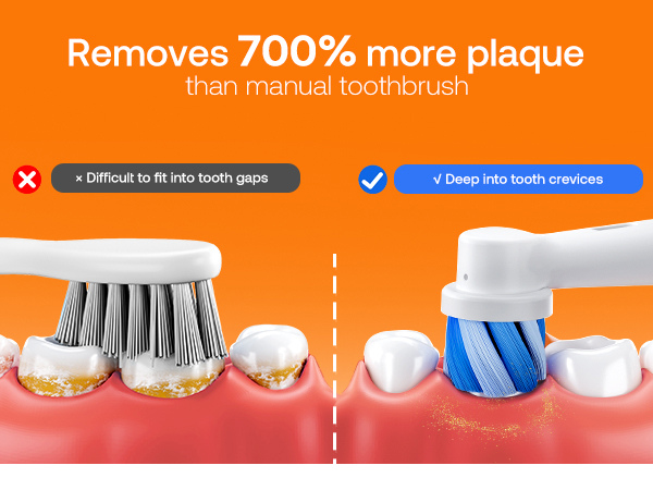Bitvae R1 Electric Toothbrush - 700% More Plaque Removal