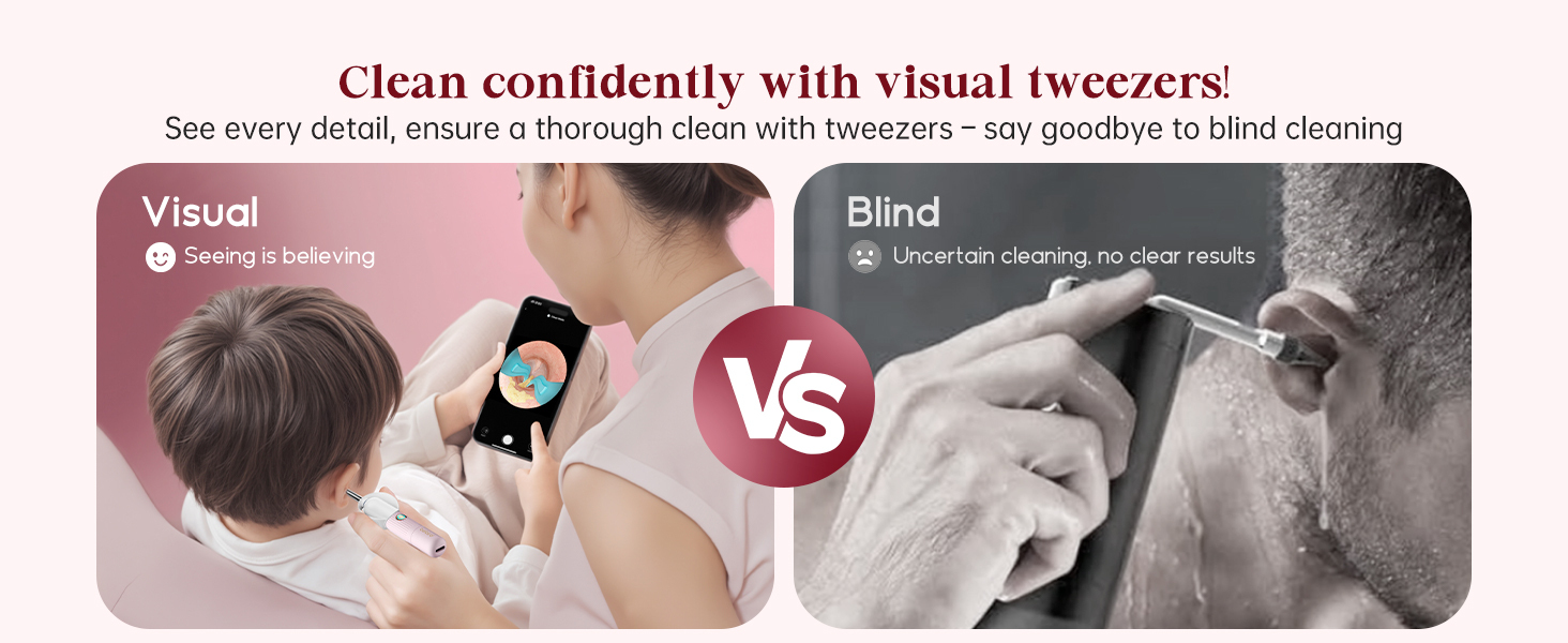 Bebird EarSight Plus Pink Ear Wax Removal Tool Camera, Ear Cleaning Kit with Flexible Visual Ear Camera Otoscope, Portable Wireless Painless Ear Cleaner with Earwax Remover Tweezers for Adults, Kids, Pets