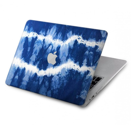 W3671 Blue Tie Dye Hard Case Cover For MacBook Pro 13″ - A1706, A1708, A1989, A2159, A2289, A2251, A2338