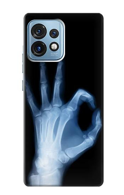 W3239 X-Ray Hand Sign OK Hard Case and Leather Flip Case For Motorola Edge+ (2023), X40, X40 Pro, Edge 40 Pro