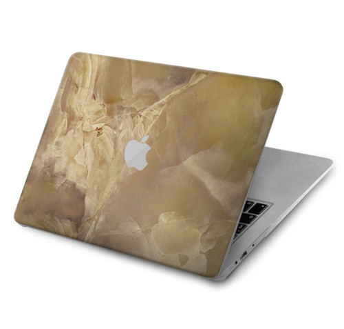 W3240 Yellow Marble Stone Hard Case Cover For MacBook Air 15″ (2023,2024) - A2941, A3114