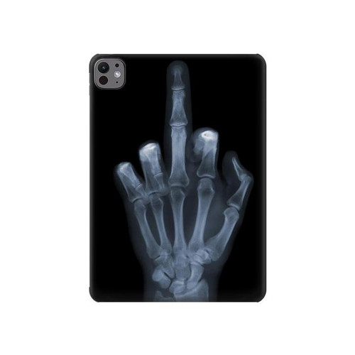 W1143 X-ray Hand Middle Finger Tablet Hard Case For iPad Pro 11 (2024)