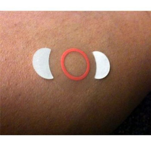 Mammography Indicator Radiolucent Circles