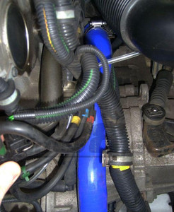 Radiator Hose Kit - Black - S60 / V70 / XC70 2002+
