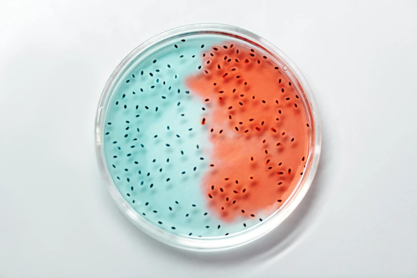 Study: How Removing LTA From a Probiotic Reduces Gut Inflammation