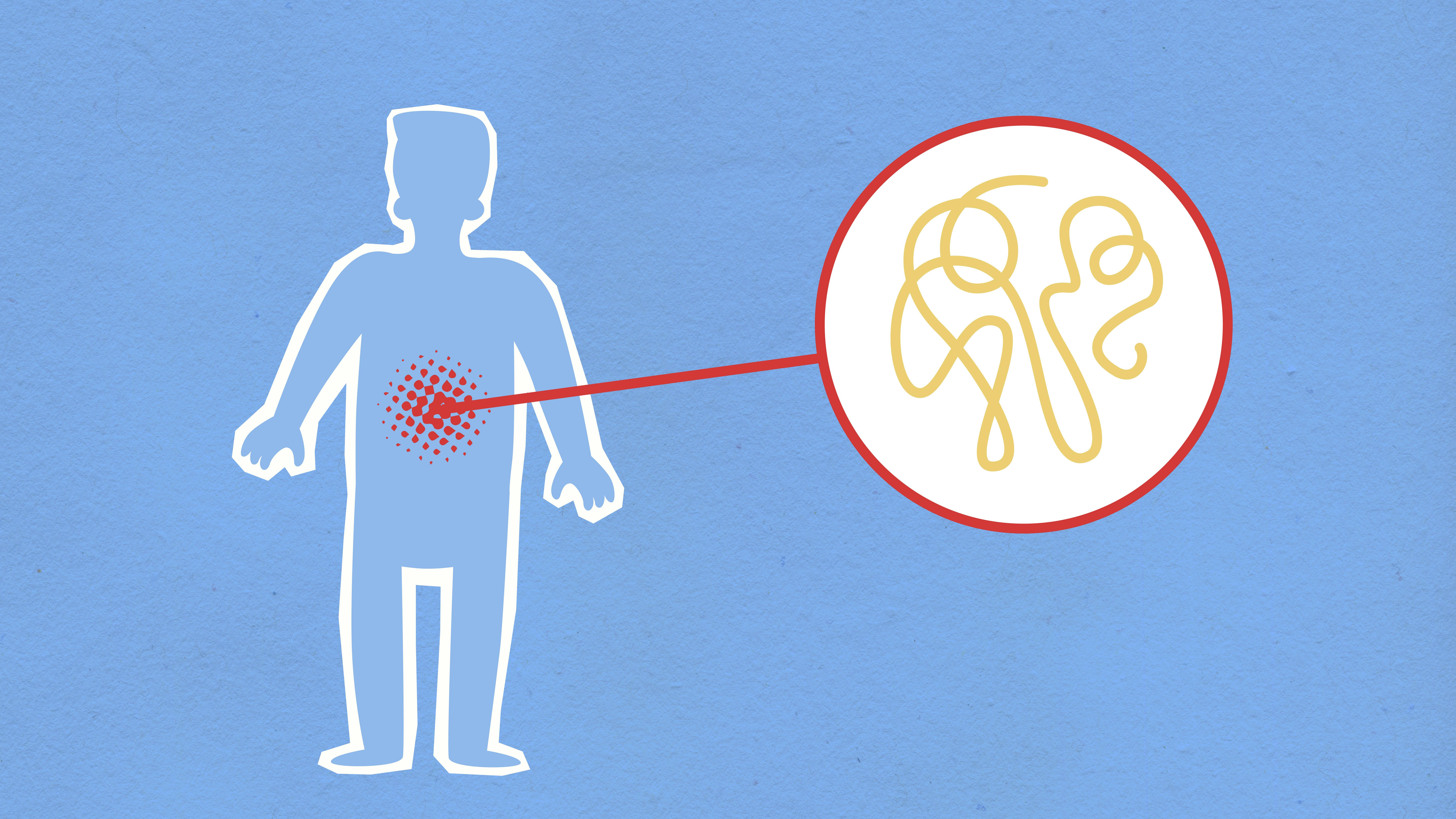 Study: L. acidophilus Outperforms Other Probiotics for IBS Abdominal Pain Relief