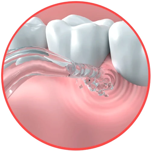 go2 dentagenie Water Flosser