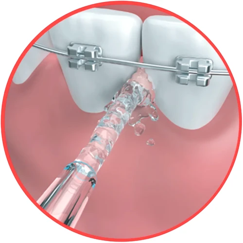 go2 dentagenie Water Flosser