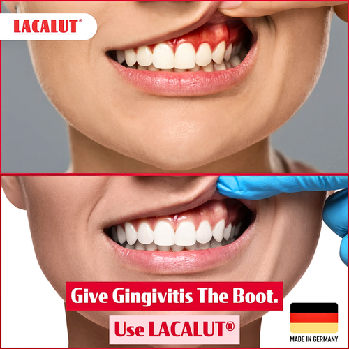 LACALUT® AKTIV Anti-Gingivitis Mouthwash For Gum Disease 300ml